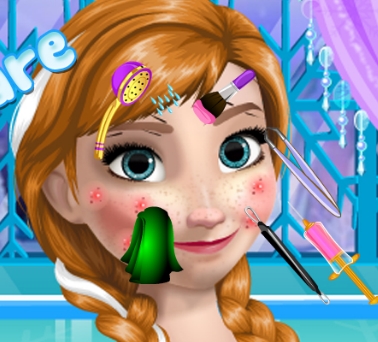 Play Anna Skin Care Game