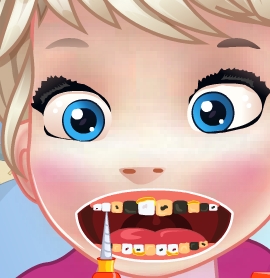 Play Baby Elsa Tooth Problems Game