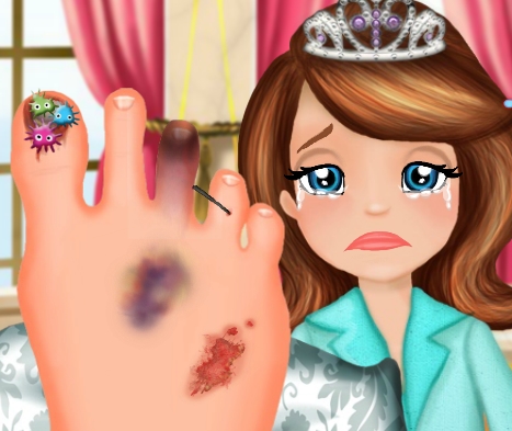 Play Sofia Foot Infection Game