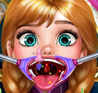 Play Anna Throat Doctor Game