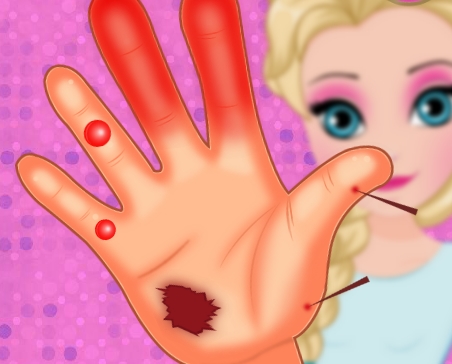 Play Elsa Hand Emergency Game