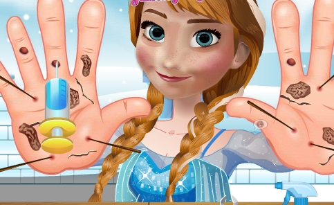 Play Anna Hand Doctor Game