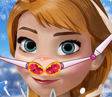 Play Anna Nose Problems Game