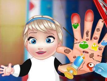 Play Baby Elsa Hand Doctor Game