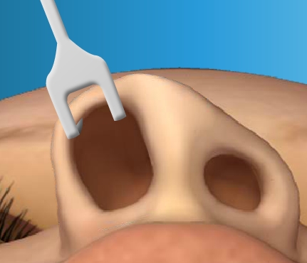 Play Virtual Nose Job Surgery Game