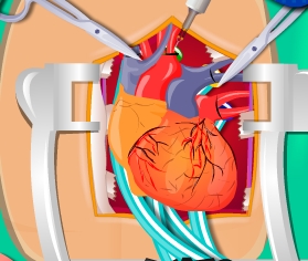 Play Heart Surgery Simulation Game