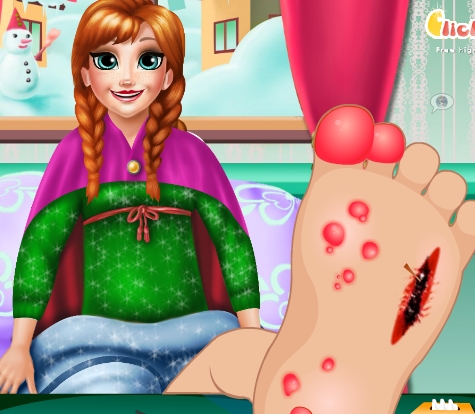 Play Anna Elsa Foot Check Up Game