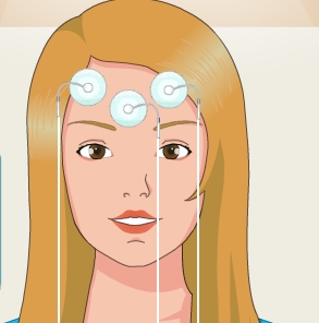 Play Epilepsy Surgery Game