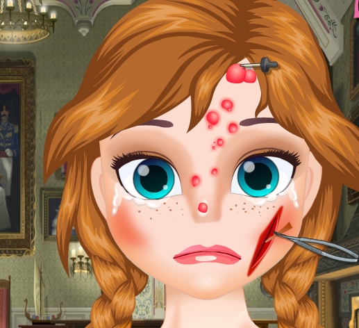 Play Anna Face Problems Game