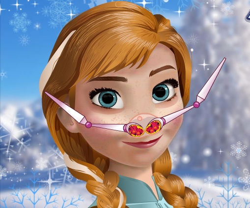 Play Anna Nose Doctor Game