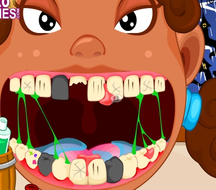 Play Dentist Crazy Day Game