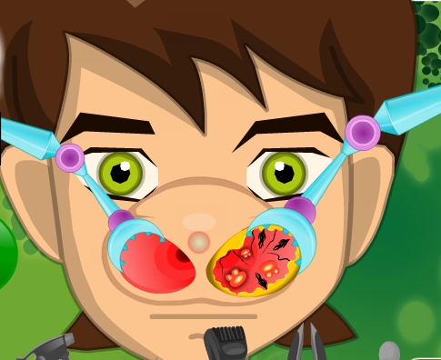 Play Ben 10 Nose Doctor Game