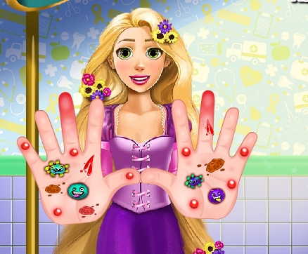 Play Rapunzel Hand Treatment Game