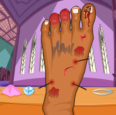 Play Clawdeen Wolf Foot Doctor Game
