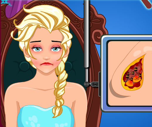 Play Elsa Nose Surgery Game