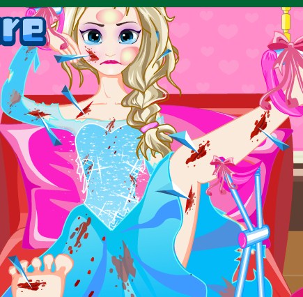 Play Elsa Leg Fracture Game