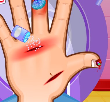 Play Hand Doctor Game