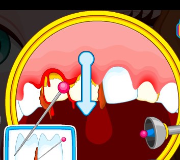 Play Dentist At School Game