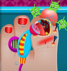 Play Broken Nail Doctor Care Game