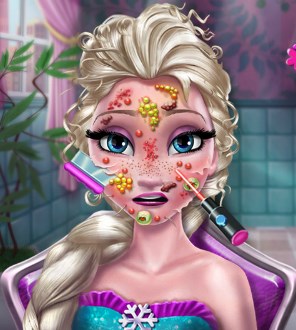 Play Elsa Skin Doctor Game