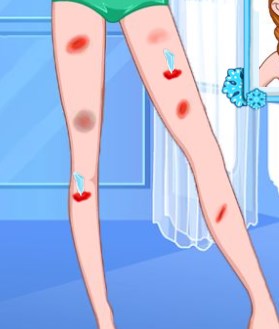 Play Anna Leg Doctor Game