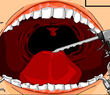 Play Dr Dentist and Exploding Teeth Game