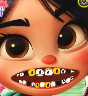 Play Vanelope Dental Care Game