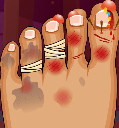 Play Monster Foot Doctor Game