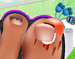 Play Nail Doctor Game