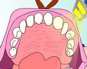 Play Monkey Dentist Game