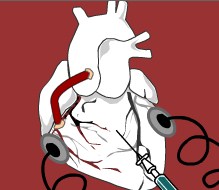 Play Heart Surgery Game