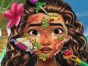 Play Moana Skin Doctor Game