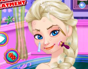 Play Ice Queen Acne Treatment Game