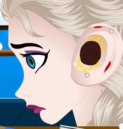 Play Frozen Elsa Ear Cleaning Game