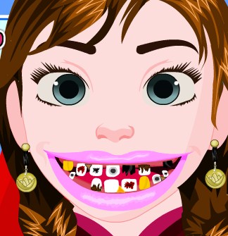 Play Frozen Anna Tooth Care Game